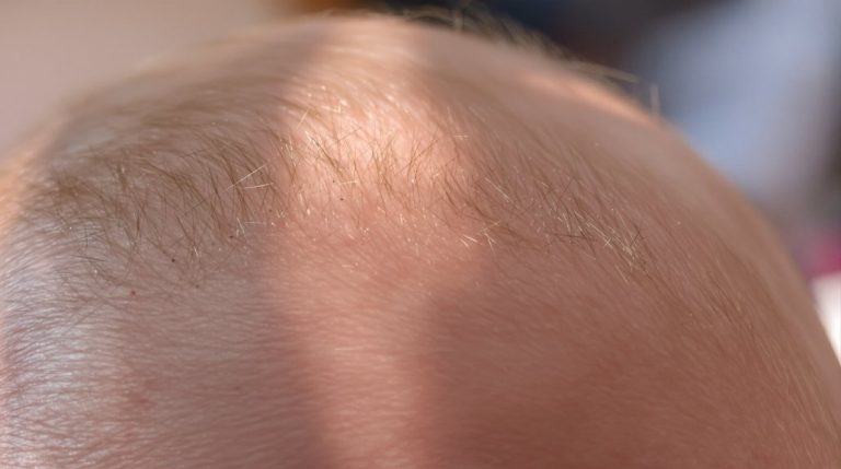 explication de la fontanelle du bébé
