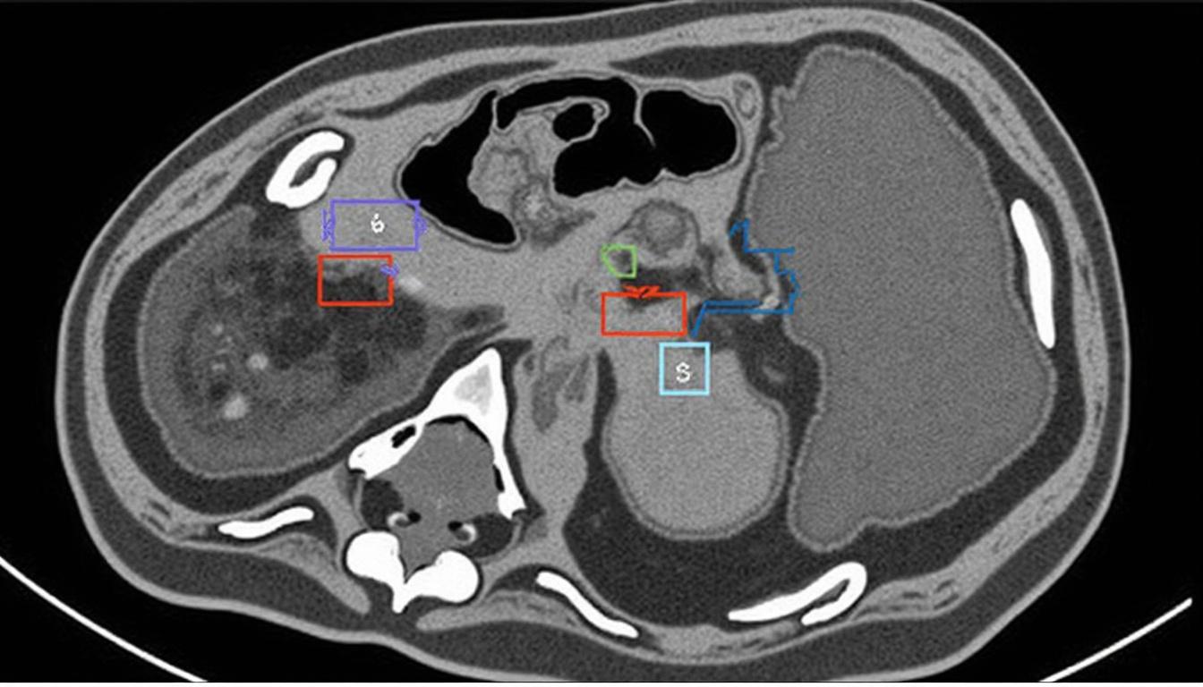 découvrez tout ce qu'il faut savoir sur la maladie de barlow : ses symptômes, ses causes et les traitements disponibles pour mieux la comprendre et la gérer.